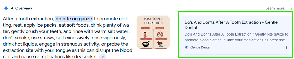 Tooth Extraction Guide